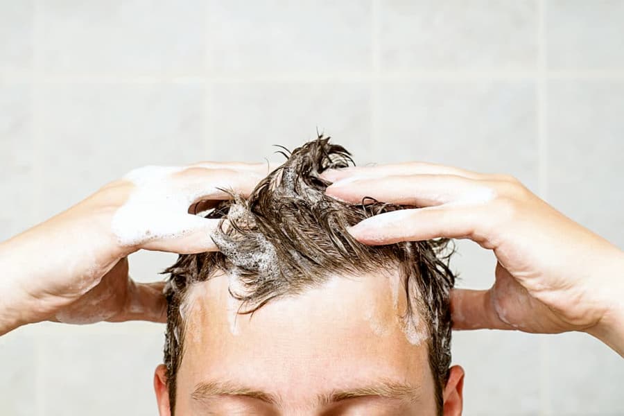 When Should You Take a Shower After Hair Transplant?